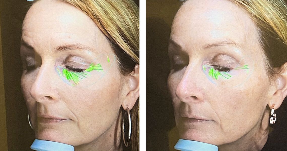 Heidi_f&oslash;r og etter.jpg